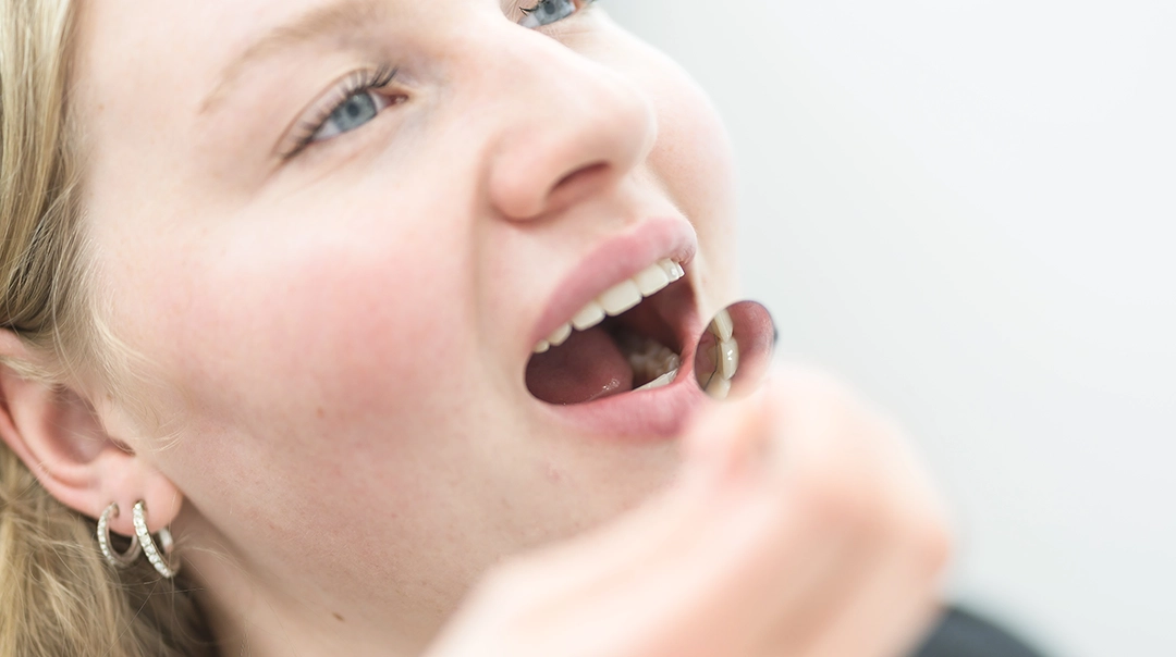 Nahaufnahme von Gebiss mit Dental Spiegel.